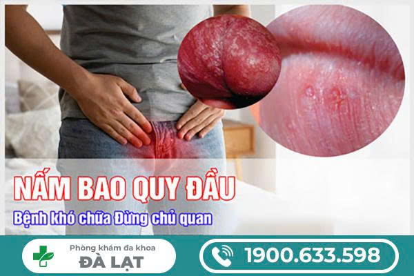 Hình ảnh minh họa